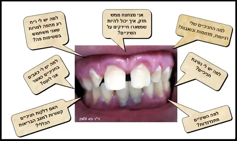 דלקות חניכיים מחלות חניכיים - שאלות נפוצות ותשובות - גיא וולפין