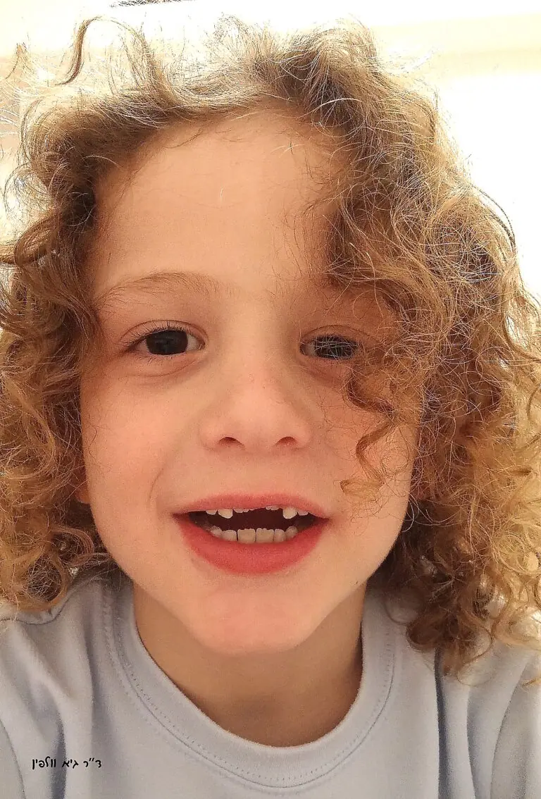 מתי בוקעות השיניים? ד"ר גיא וולפין